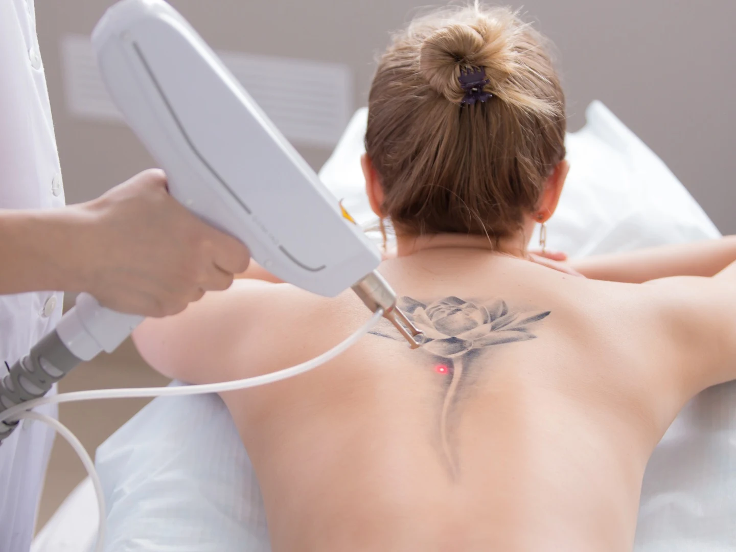 How Much Does It Cost For Laser Tattoo Removal?